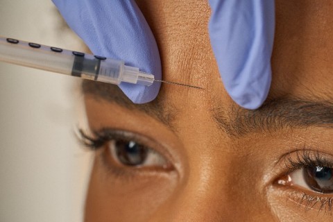 Porque o “Botox” é o procedimento estético mais realizado no mundo?